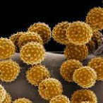 Pollen Allergies Santa Barbara